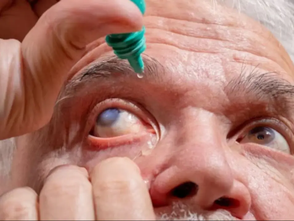 ਹੀਟਵੇਵ ਅਲਰਟ! ਆਪਣੀਆਂ ਅੱਖਾਂ ਦੀ ਸੁਰੱਖਿਆ ਲਈ ਇਹ ਕਦਮ ਉਠਾਓ